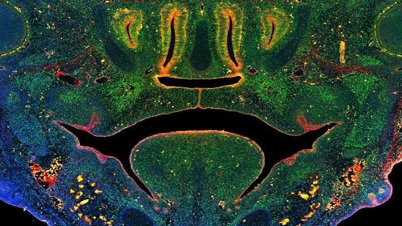 This image of a section through the midface of a mouse embryo illustrates fusion of the tissues that form the secondary palate above the tongue. Green staining illustrates cells expressing a key enzyme that mediates DNA methylation, blue indicates nuclei of all cells, red indicates epithelial cells. CREDIT: University of Wisconsin–Madison